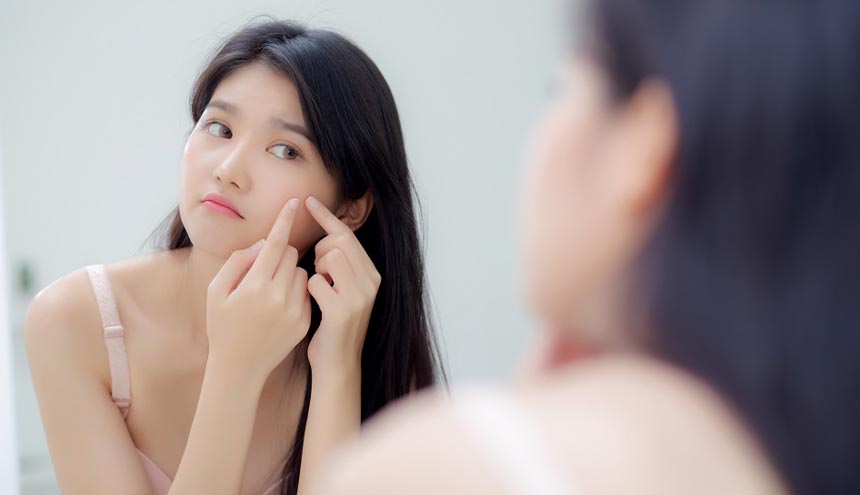 5 Cara Memilih Skincare untuk Kulit Berminyak dan Berjerawat