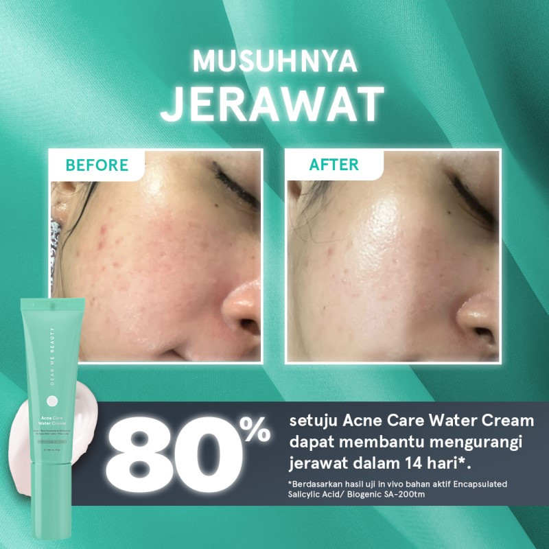 Jual Dear Me Beauty Acne Care Water Cream Termurah September 2024