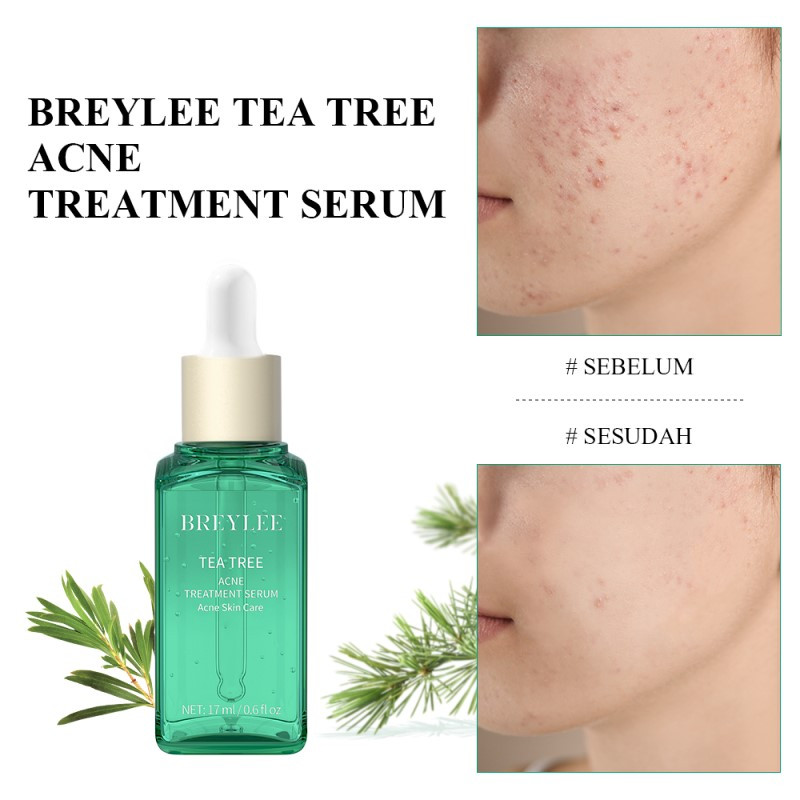 Jual Breylee Tea Tree Acne Treatment Serum Termurah Mei 2024 | BeautyHaul