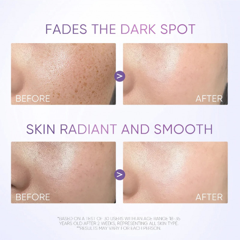 SymWhite377_Dark_Spot_Eraser_Serum-731.jpg