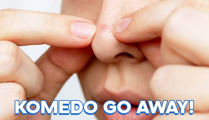 Komedo Go Away! Cari Skincare Buat Hilangkan Komedo di Sini!